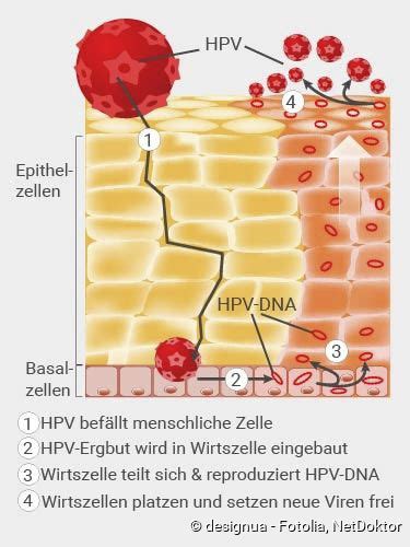 hpv porn|Humane Papillomviren (HPV) » Übertragung & Verbreitung